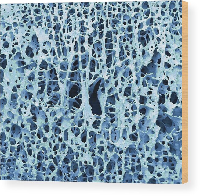 Anatomical Wood Print featuring the photograph Bone Tissue #5 by Steve Gschmeissner