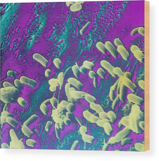 Bacteria Wood Print featuring the photograph Bacteria On Tooth Enamel Sem by Chris Bjornberg
