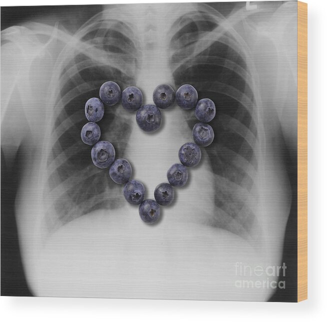 X-ray Wood Print featuring the photograph Blueberries, Heart Healthy Food by Gwen Shockey