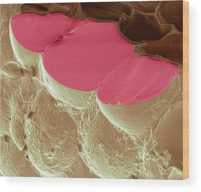 Adipocyte Wood Print featuring the photograph Fat Cells by Steve Gschmeissner/science Photo Library