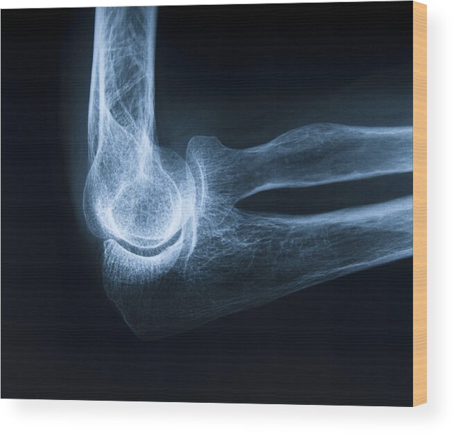 Thumb Wood Print featuring the photograph Human elbow bone by GeorgHanf