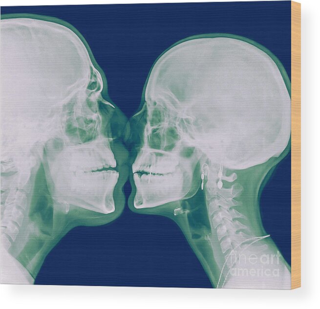 Bizarre Wood Print featuring the photograph X-ray kissing by Guy Viner