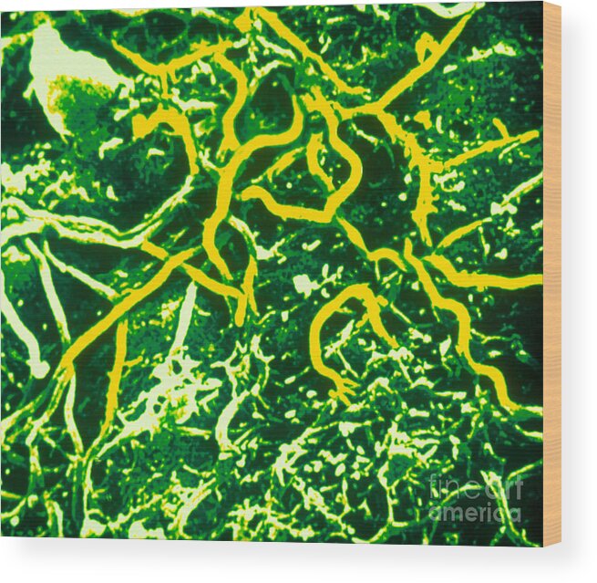 Tem Wood Print featuring the photograph Borrelia Burgdorferi #4 by Science Source