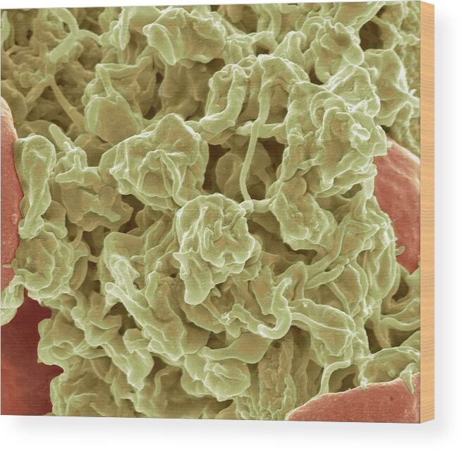 Biological Wood Print featuring the photograph Platelets, Sem by Steve Gschmeissner