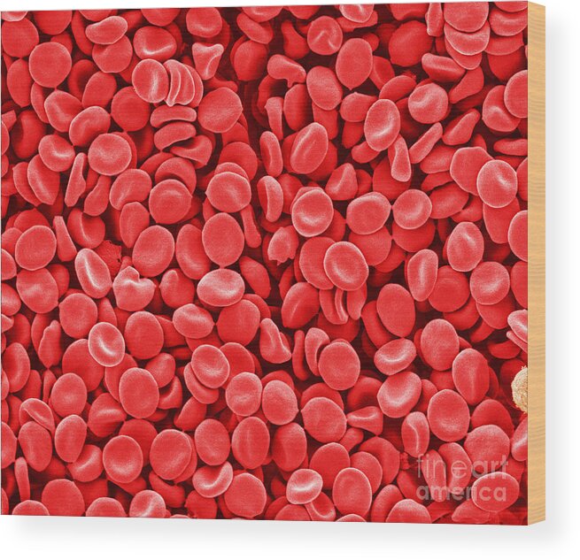 Red Blood Cells Wood Print featuring the photograph Red Blood Cells, Sem #4 by Scimat