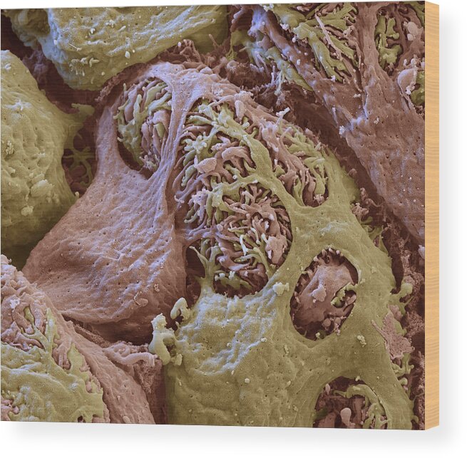 Excretory System Wood Print featuring the photograph Kidney Glomerulus, Sem #1 by Oliver Meckes EYE OF SCIENCE