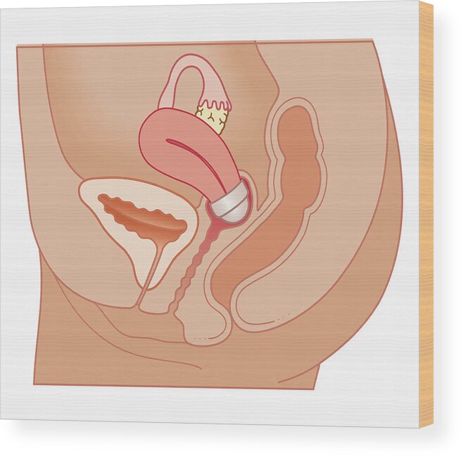Cervix Wood Print featuring the digital art Cross Section Biomedical Illustration #14 by Dorling Kindersley