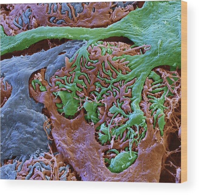 Excretory System Wood Print featuring the photograph Kidney Glomerulus, Sem #2 by Oliver Meckes EYE OF SCIENCE