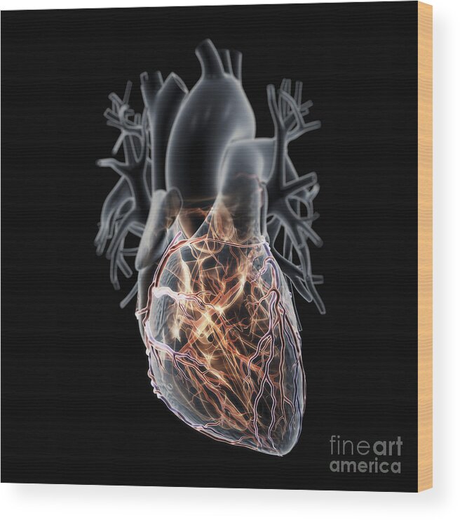 3d Visualisation Wood Print featuring the photograph Coronary Blood Supply #11 by Science Picture Co