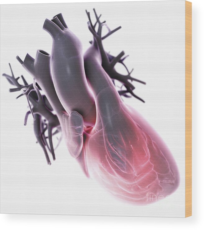 Right Ventricle Wood Print featuring the photograph Heart Anatomy #2 by Science Picture Co