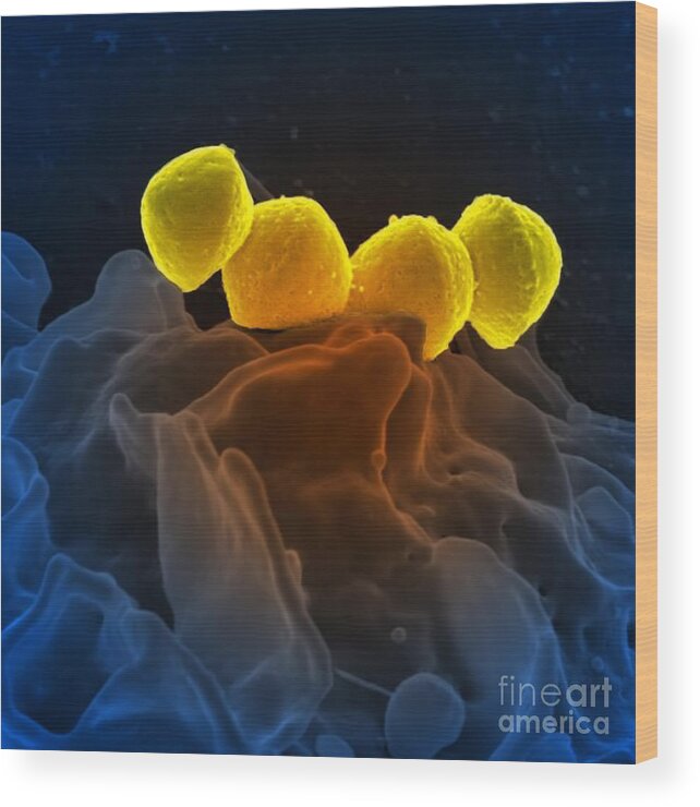 Microbiology Wood Print featuring the photograph Streptococcus Pyogenes Bacteria Sem #3 by Science Source