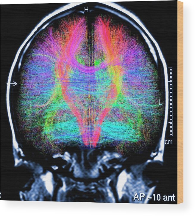 Brain Scan Wood Print featuring the photograph Brain Mri And White Matter Fibres by Alfred Pasieka/science Photo Library