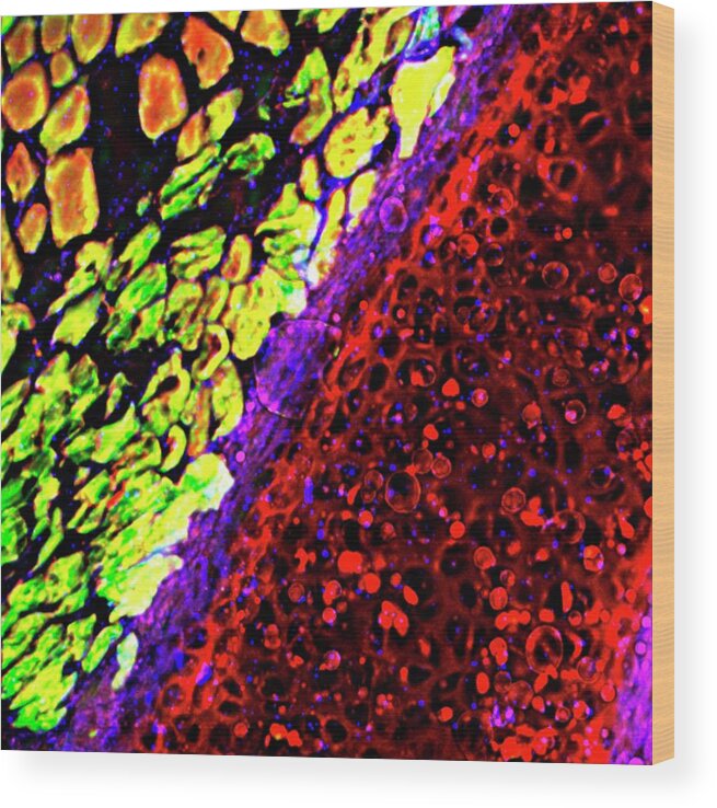 Tissue Wood Print featuring the photograph Throat Tissue by R. Bick, B. Poindexter, Ut Medical School/science Photo Library