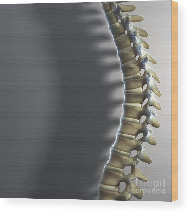 Close-up Wood Print featuring the photograph Spinal Anatomy #6 by Science Picture Co
