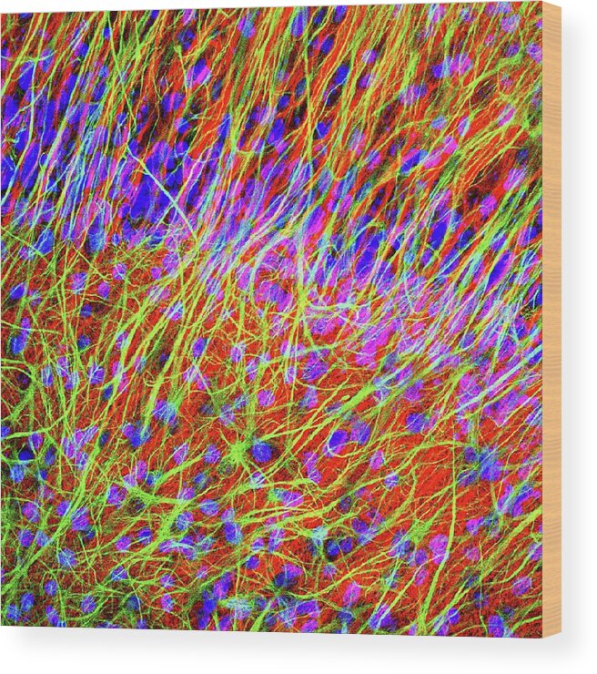 Anatomical Wood Print featuring the photograph Brain Cells #9 by Dr. Chris Henstridge