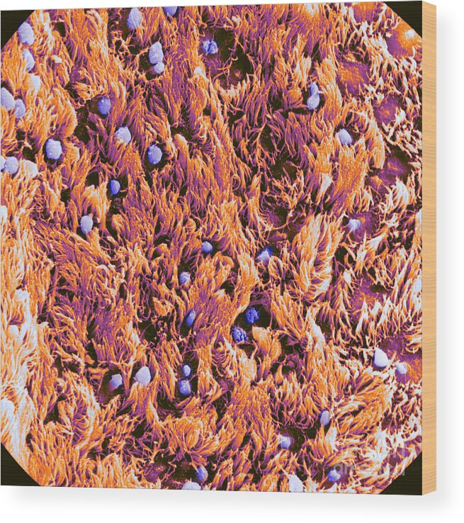 Human Wood Print featuring the photograph Trachea, Showing Cilia And Goblet by Biophoto Associates