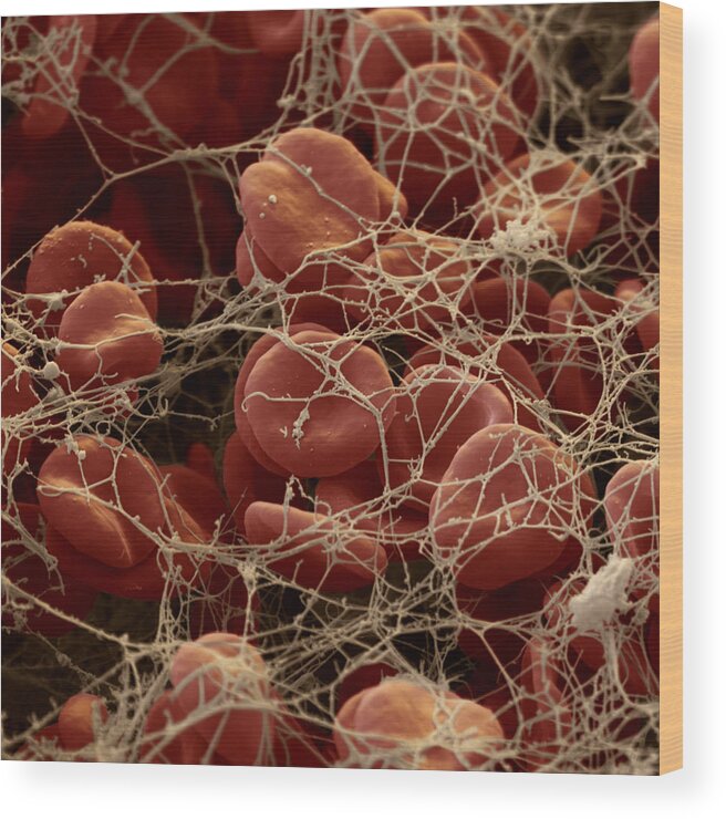 Blood Wood Print featuring the photograph Blood Clot #1 by Oliver Meckes EYE OF SCIENCE