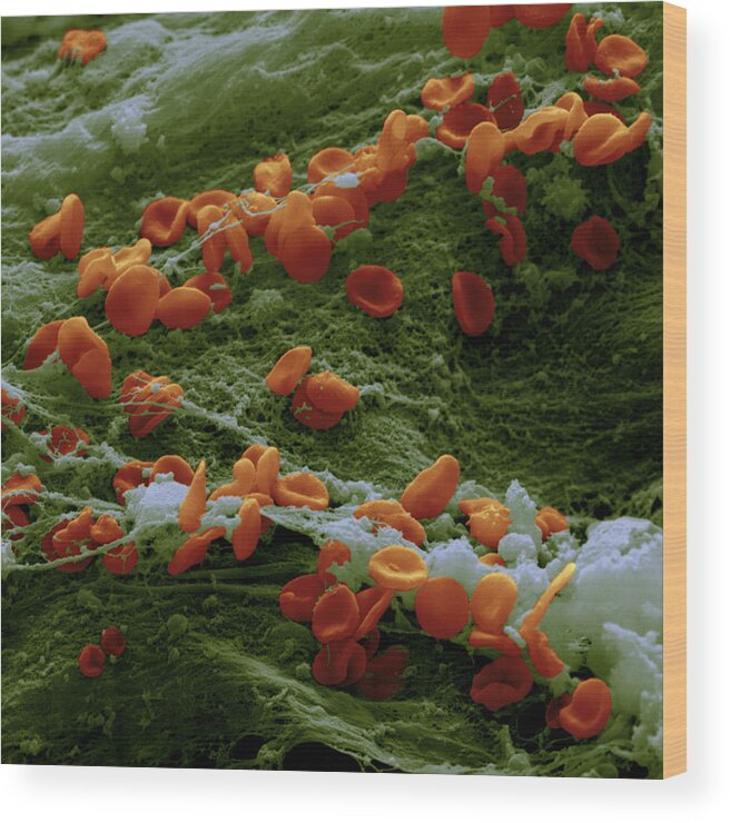 Blood Wood Print featuring the photograph Erythrocytes And Fibrin Threads #1 by Meckes/ottawa