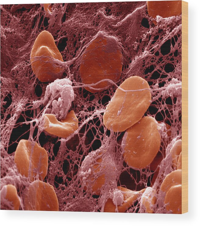 Blood Wood Print featuring the photograph Erythrocytes And Fibrin Threads #2 by Meckes/ottawa