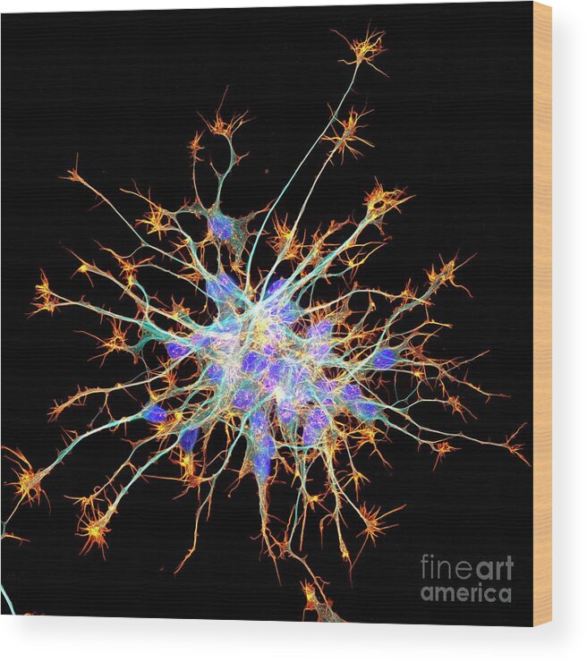 Actin Wood Print featuring the photograph Neurons From Stem Cells by Dr Torsten Wittmann/science Photo Library