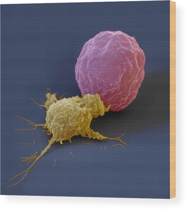 Antigen Wood Print featuring the photograph Killer Cell And Cancer Cell by Meckes/ottawa