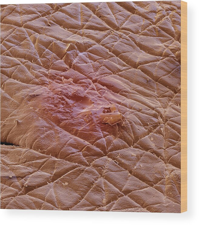 Acne Wood Print featuring the photograph Pimple by Meckes/ottawa