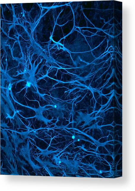 Stem cell-derived nerve cells #4 Canvas Art Print by Science Photo Library