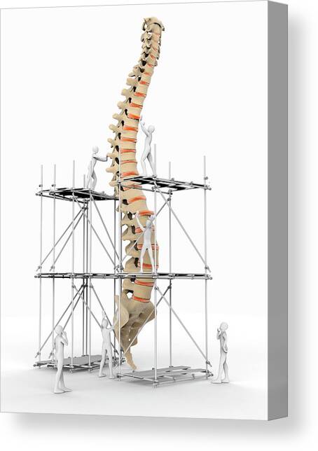 Spine With Workers Canvas Art Print by Science Photo Library