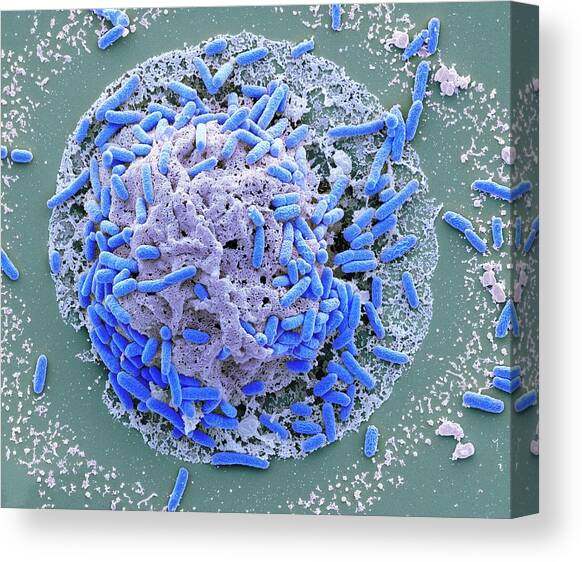 E. Coli Induced Cell Death #1 Canvas Art Print by Science Photo Library