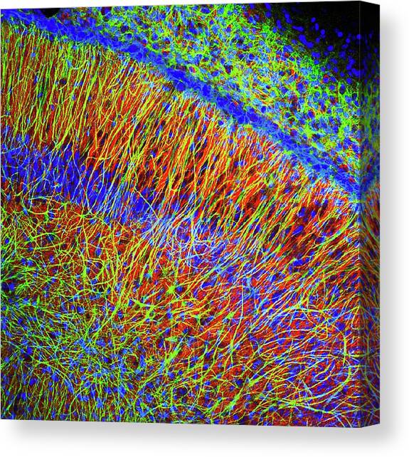 Brain Cells #2 Canvas Art Print by Science Photo Library