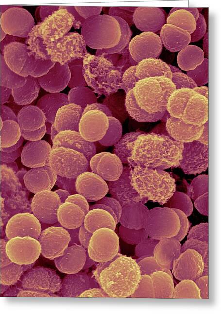 Deinococcus Radiodurans Greeting Cards for Sale - Fine Art America