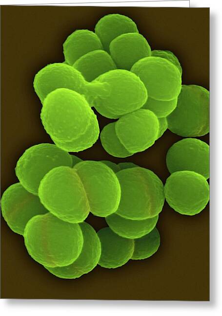 Deinococcus Radiodurans Art Radiotrophic Bacteria Print 