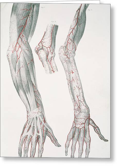 Arm Arteries Photograph by Sheila Terry/science Photo Library