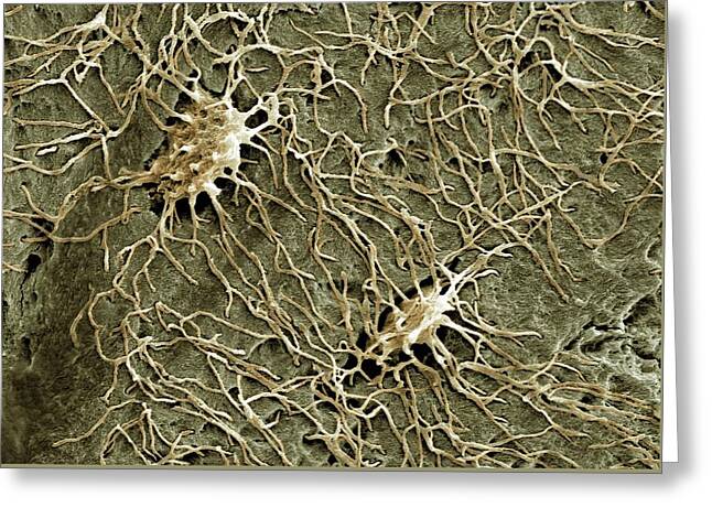 Osteocyte Greeting Cards