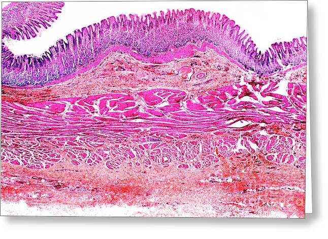 Smooth Muscle Greeting Cards