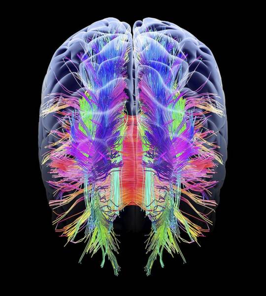 White Matter Fibres And Brain, Artwork #2 Art Print