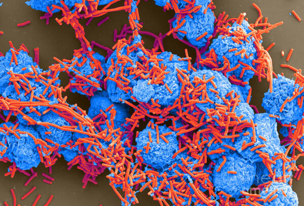 E Coli And Macrophages Sem Art Print
