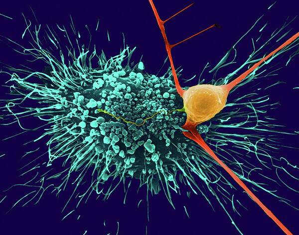 Astrocytic Glial Cell With Cortical Neuron Art Print