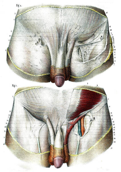 Diagram Of Male Groin Area - Lymphedema of the leg: Images ...