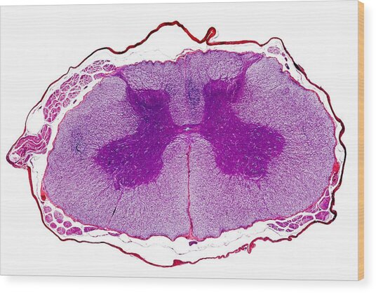 Spinal Cord, Transverse Section Photograph by Dr Keith Wheeler