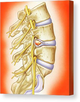 Intervertebral Disc Canvas Prints