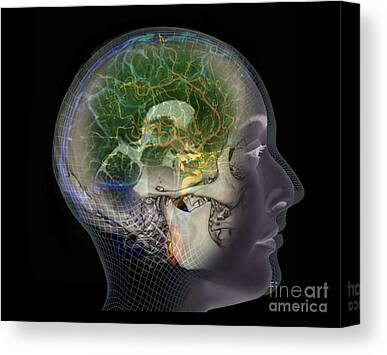 Normal Cerebral Angiogram Canvas Prints