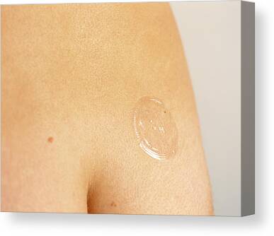 skin patches - Search - Science Photo Library