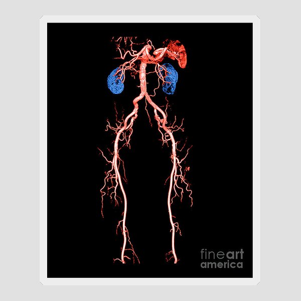 Ultrasound Sticker by Medical Body Scans - Fine Art America