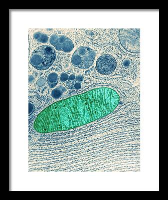 Pancreatic Framed Prints