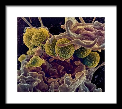 Hospital Acquired Infection Framed Prints