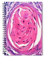 Malignancy Spiral Notebooks