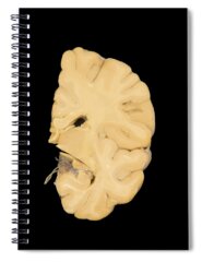 Coronal Section Spiral Notebooks