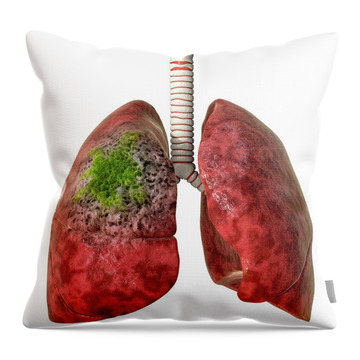 Designs Similar to Lung Cancer #2