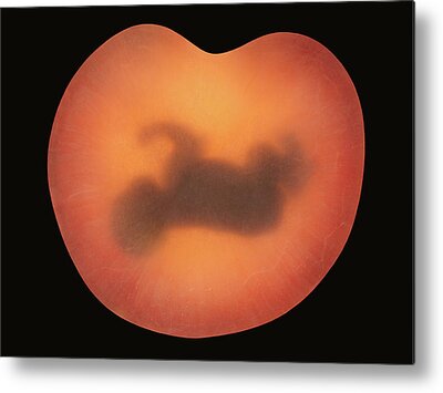 Embryo Metal Prints